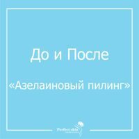 Азелаиновый пилинг
