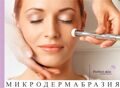 Микродермабразия